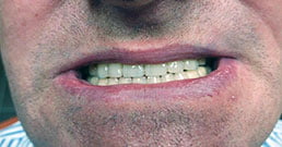 Zahnarzt in Ungarn Erfahrungen