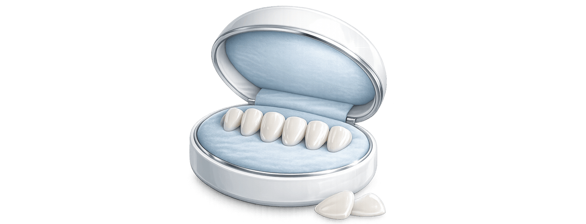 Veneers Paket